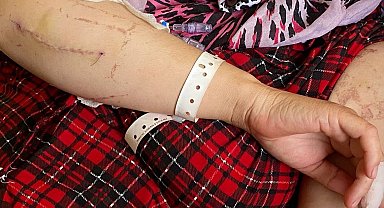 Evin elektriğini kesip kapıyı açtıran eşi tarafından 24 yerinden bıçaklandığı anları gözyaşları içinde anlattı