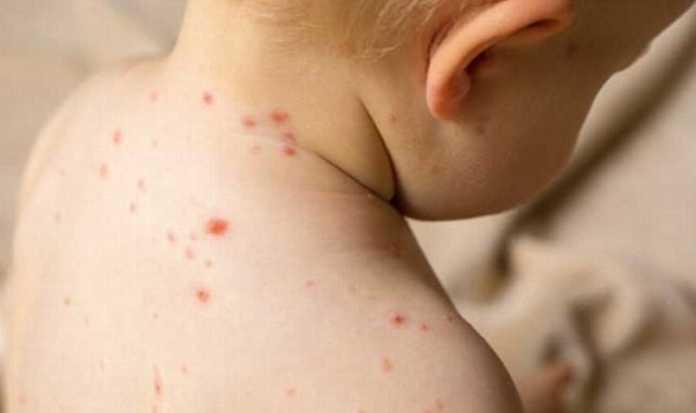 Risk grubundakiler için hayati tehlike olabiliyor