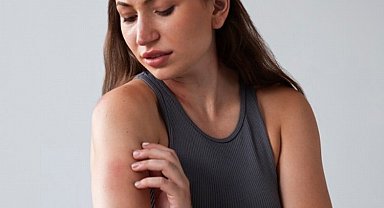 Sivrisinek ısırığında solüsyonlara alternatif ürünler