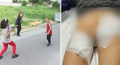 İstanbul'da 7 yaşındaki çocuğa sokak köpekleri saldırdı