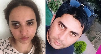 Boşanma aşamasındaki eşinden şiddet gördü!