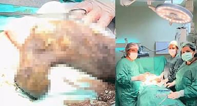 Doktorlar bile gördüğüne inanamadı