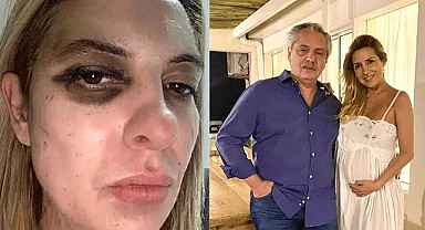 Eski Devlet Başkanından Eşine Şiddet