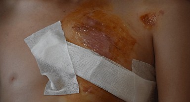 İş ihmalkarlığı can alıyordu