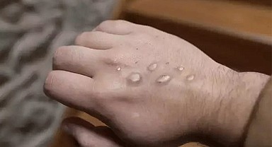 Pakistan Sağlık Bakanlığından önemli uyarı
