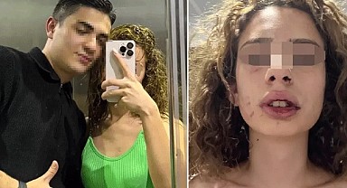 Sana Sürprizim Var Dedi Vahşeti Yaşattı