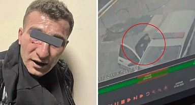 2 polis memurunu bıçaklayan saldırganın ifadesi pes dedirtti