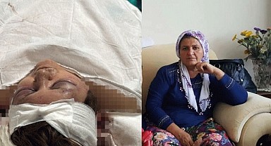 Gelin kaynanasını tuğlayla dövdü!