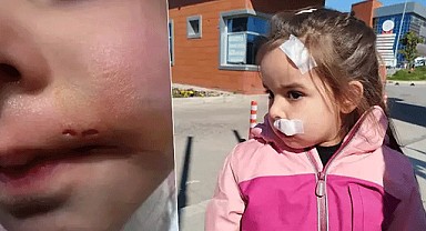 İzmir'de sahipsiz köpek dehşeti