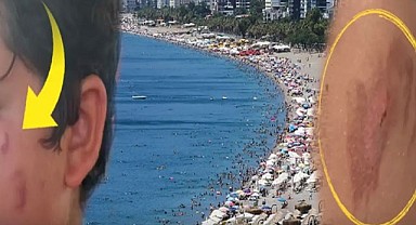 Uzmanlardan Deniz Uyarısı