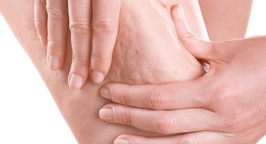 Prof. Dr. Karacalar'dan selülit uyarısı: Portakal kabuğu görüntüsü basit sorun değil!