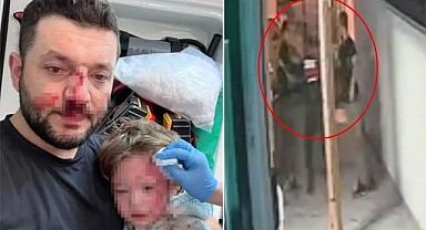 Bebek ve Baba Darbedildi Görüntüler Ortaya Çıktı