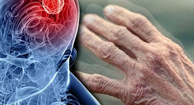 Tarım ilaçları parkinson riskini artırabilir